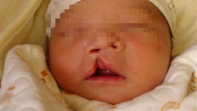 产妇生下&quot;兔唇宝宝&quot;，谎称孕期吃了兔肉，医生说破后婆婆很生气