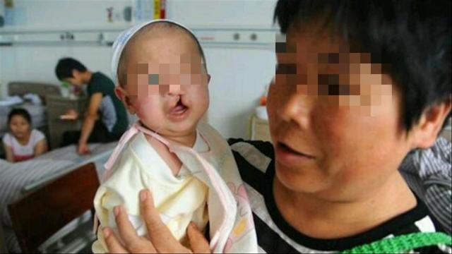 产妇生下&quot;兔唇宝宝&quot;，谎称孕期吃了兔肉，医生说破后婆婆很生气