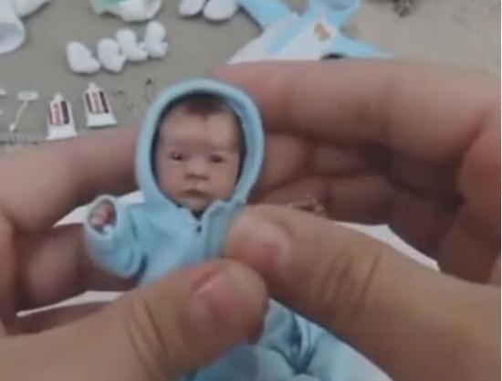 男子给拇指婴儿穿衣服，父母抱宝宝纷纷驻足，看清后感觉不可思议