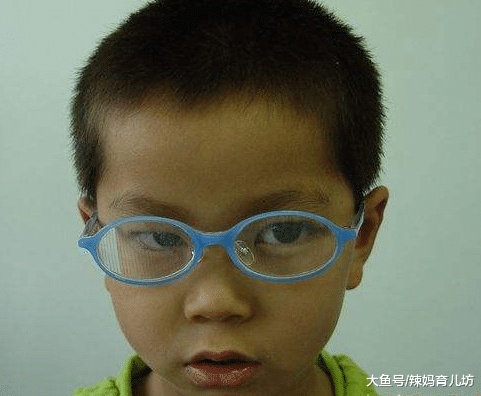 4岁孩子常玩这种玩具，结果黑眼珠越来越小，家长们留意了