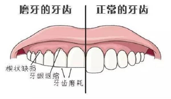 孩子睡觉磨牙，是因为有虫子吗？不是！崔玉涛医生告诉你2个原因