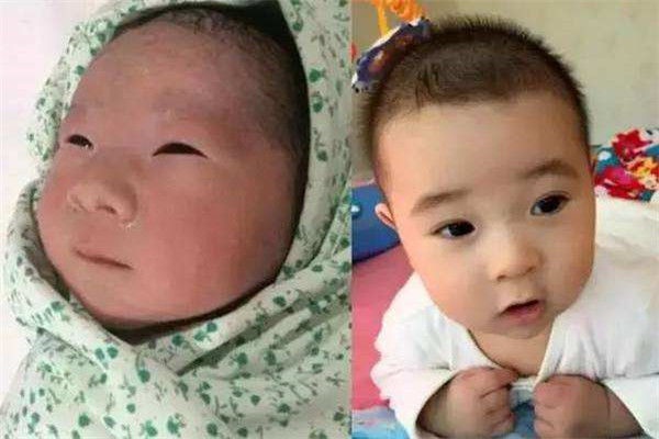 “医生，能把孩子再塞回去吗”，医生：这三个地方越丑，长大越美