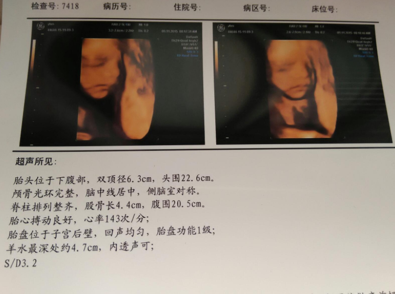 肚里怀男宝8个月，说下我孕期的一些症状，大家看看有没有相同的