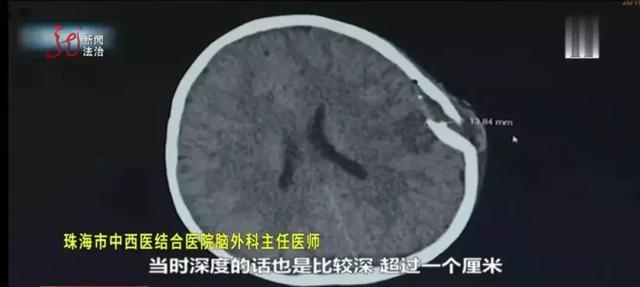 为了女儿开心，父亲将其“举高高”，旋转的吊扇却撞向了女儿头部