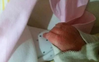 5个月宝宝全身开裂，只因婆婆这个习惯，7成家长也会这么做