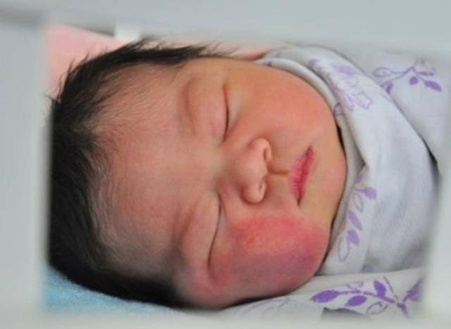 宝宝脸上的“产钳印”迟迟不消，婆婆的一句埋怨，让宝妈忍不住了