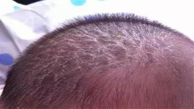 3个月宝宝差点成“脑瘫”，医生呵斥妈妈大意，这个部位碰不得