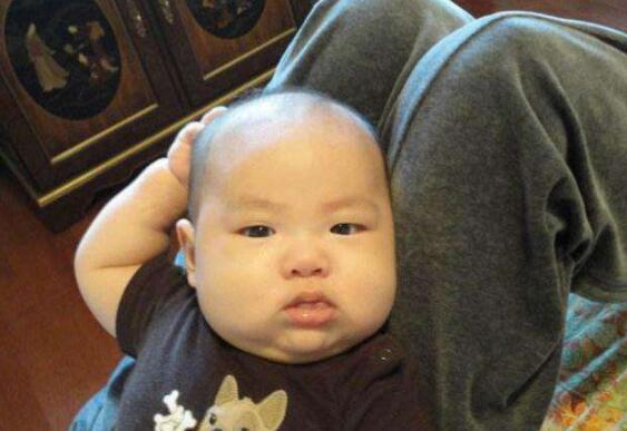 2岁宝宝总爱摸脑袋，妈妈发现异常，检查后医生的话让她庆幸不已