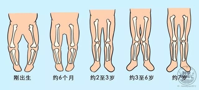 腿型不好毁身高！自查宝宝身材潜力