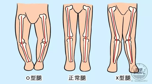腿型不好毁身高！自查宝宝身材潜力