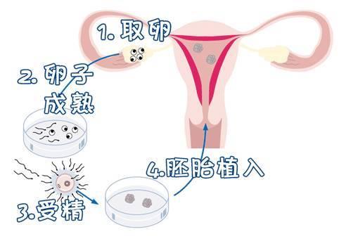 从胚胎形成到传宗接代，试管婴儿和正常婴儿有什么区别？