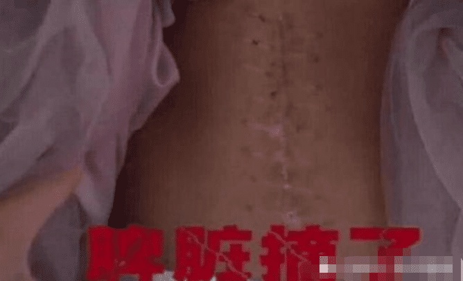 孩子器官被摘除，家长找幼儿园索赔，网友：25万算少的了