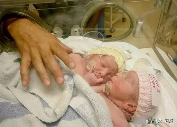 ＂怀孕16周检查出是连体女婴，妈妈冒险生下现孩子已快乐入学＂