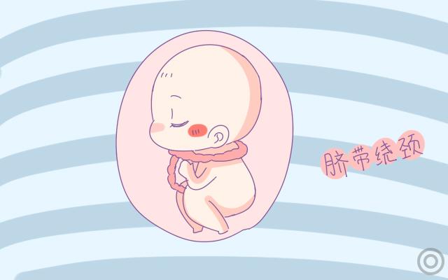 孕期3种不良习惯，容易致使胎儿被脐带缠绕！孕妈要远离