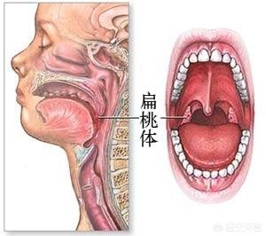 做过腺样体切除的孩子后来怎么样了？