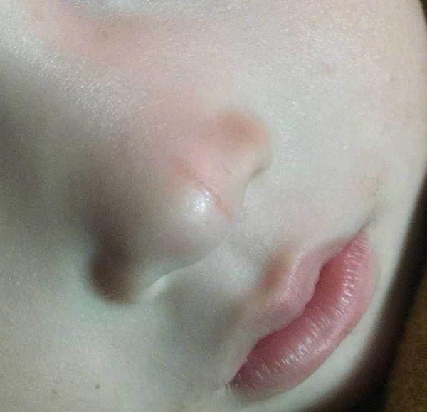 宝宝脾胃好不好，从他脸上这3个部位就能看出来，你注意到了吗？