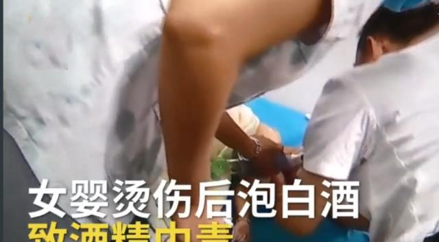 8月大女婴被开水烫伤，糊涂家长不去医院竟信偏方，差点酿成大祸