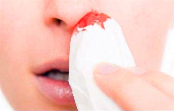 孕妇流鼻血怎么办？5个诱发孕妇流鼻血的原因，3个安全2个危险