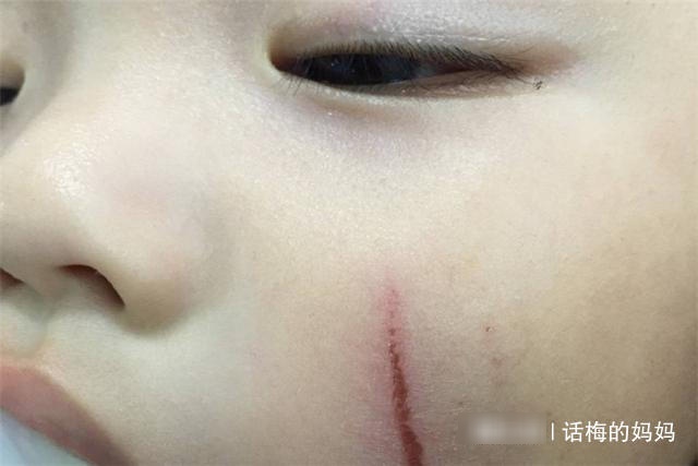 二胎妈妈如何照顾两个娃？让大宝照顾二宝时，妈妈也别撒手不管