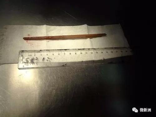 1岁半女童脑子被刺穿，只因走路时拿这东西玩！家家都有