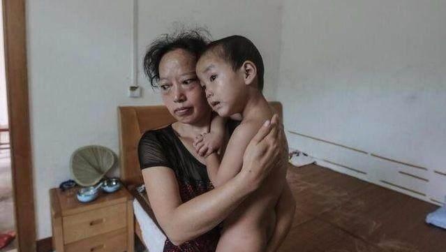 一对特殊的双胞胎小男孩，每天都不能穿衣服，有生命危险！