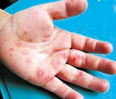 这4种疫苗虽然要自费，但对宝宝健康很重要，若条件允许尽量别省