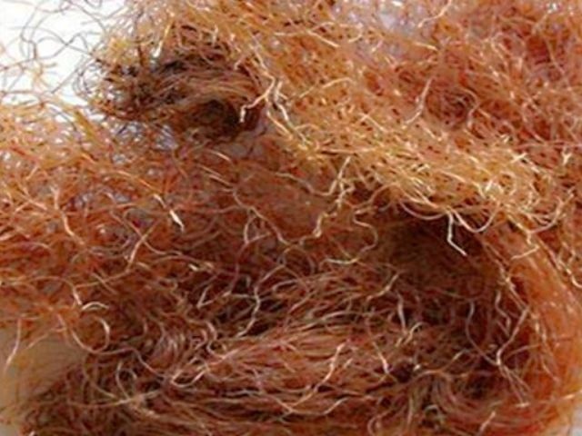 孕妈怀孕后多吃4物，或有助于排出胎毒，宝宝出生后皮肤白嫩