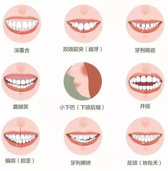 「兰州德尔牙科医院」新学期，粉碎那些“牙齿矫正”的谣言