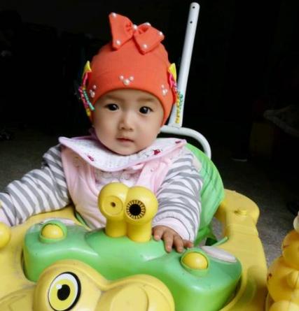 女儿在幼儿园被划伤脸，园长的做法，让妈妈忍无可忍