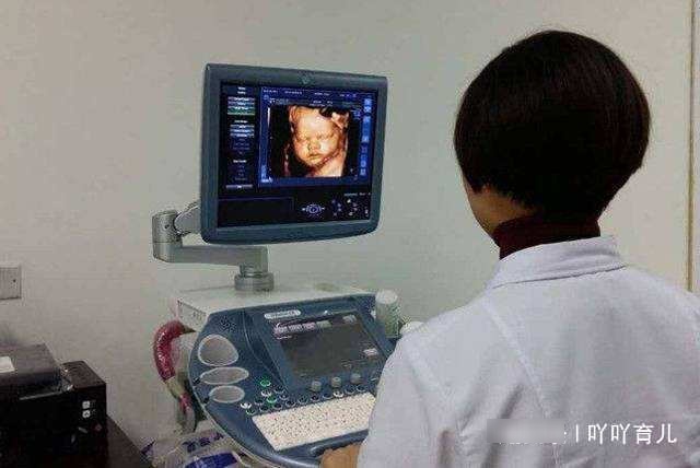产检发现胎儿一直微笑，孕妇很开心，医生却建议不能留