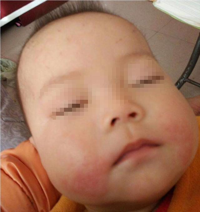 孩子每次用嘴呼吸都是在“毁容”，改不掉这坏习惯，只会越长越丑