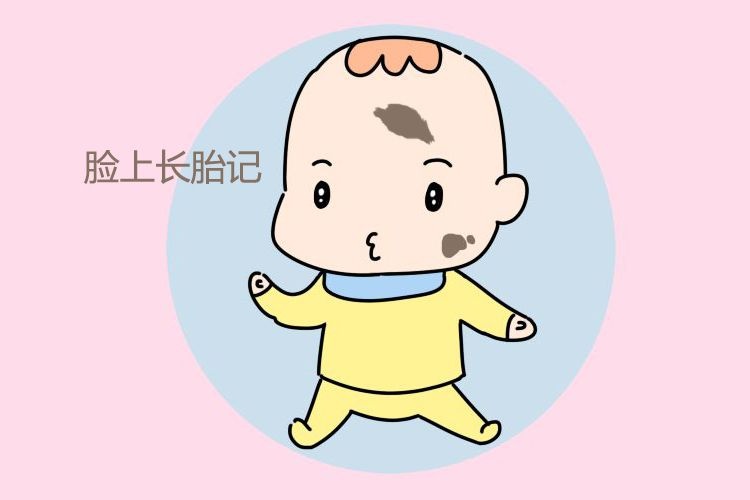 孕妈有3种习惯，要注意，不然宝宝易长大胎记，会影响身心成长