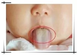 宝宝发出的这些积食信号，你能读懂吗？