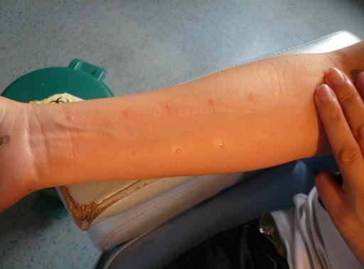 ���Ϲ����Ա��ף����ɸ�����Դ��ҽ����������2����͹���