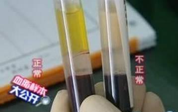 各年龄血压、血糖、血脂、血尿酸对照表,太全了,人手一份