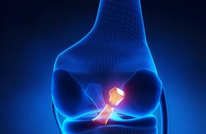 How to Build Muscle After Posterior Cruciate Ligament Surgery? How Long to Wear the Brace? How to Train Knee Flexion Angle?