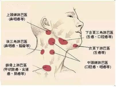 什么是淋巴结肿大?4大病因揭示意义重大,早看医生不误诊