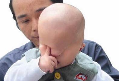 孩子天生就没有眼睛,父母不离不弃,父母该如何对付残疾儿童?