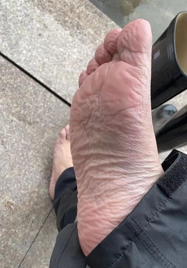 萧山河上派出所辅警陈钟杰 在抗台一线奋战十多个小时, 一双脚几乎都