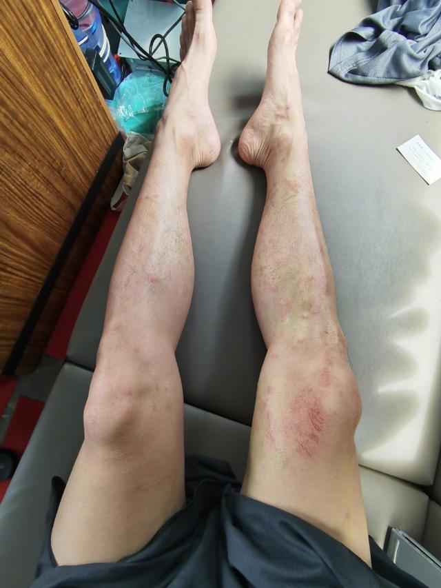 陈学冬晒船上帅气自拍 下海拍摄腿上被水母蜇伤