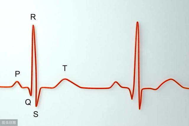 年轻人心电图t波高尖图片