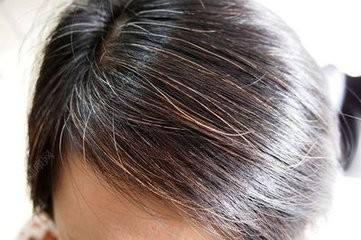 中焦内热!中医决明子茶饮,既改善头顶白发,又清肠胃