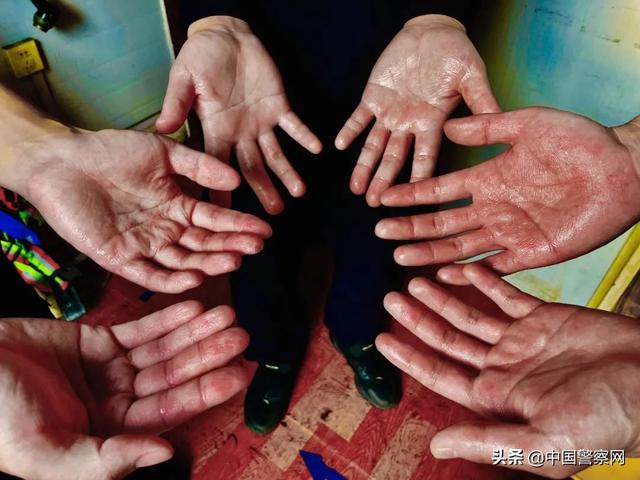 风的防护服,就像"站在大蒸笼里执勤",一趟检查下来,浑身湿透,手脚被泡