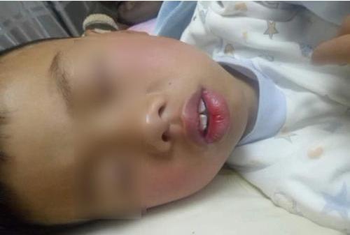 照片一对比,终于发现了不对劲的地方: 小兵的嘴部凸出,外翻得非常明显