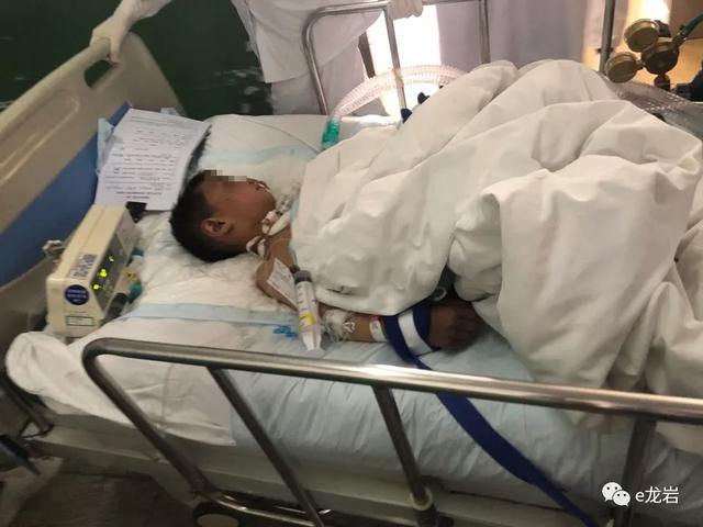 摔伤,烧伤,撞伤等儿童居家意外伤害频发,龙岩家长们千万小心!