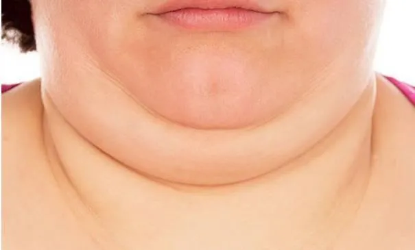 最新研究发现:脖子粗,肚子大的人基本和长寿无缘